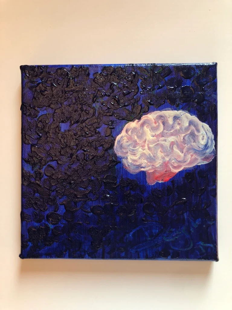 The Universe world like a brain